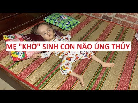 Người mẹ khờ khạo bị "xâm hại" từ năm 14 tuổi sinh ra con não úng thủy!!!